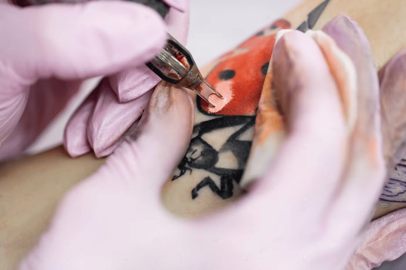 Treating an itchy tattoo
